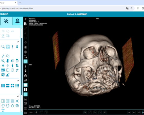 DICOM 3D Viewer free