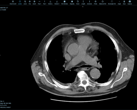 DICOM Viewer Free Online