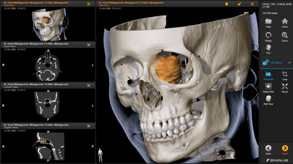 dicom viewer free online