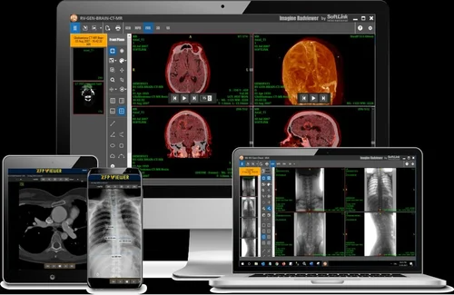 open source radiology information systems