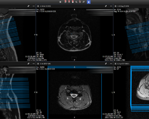 open source radiology information systems