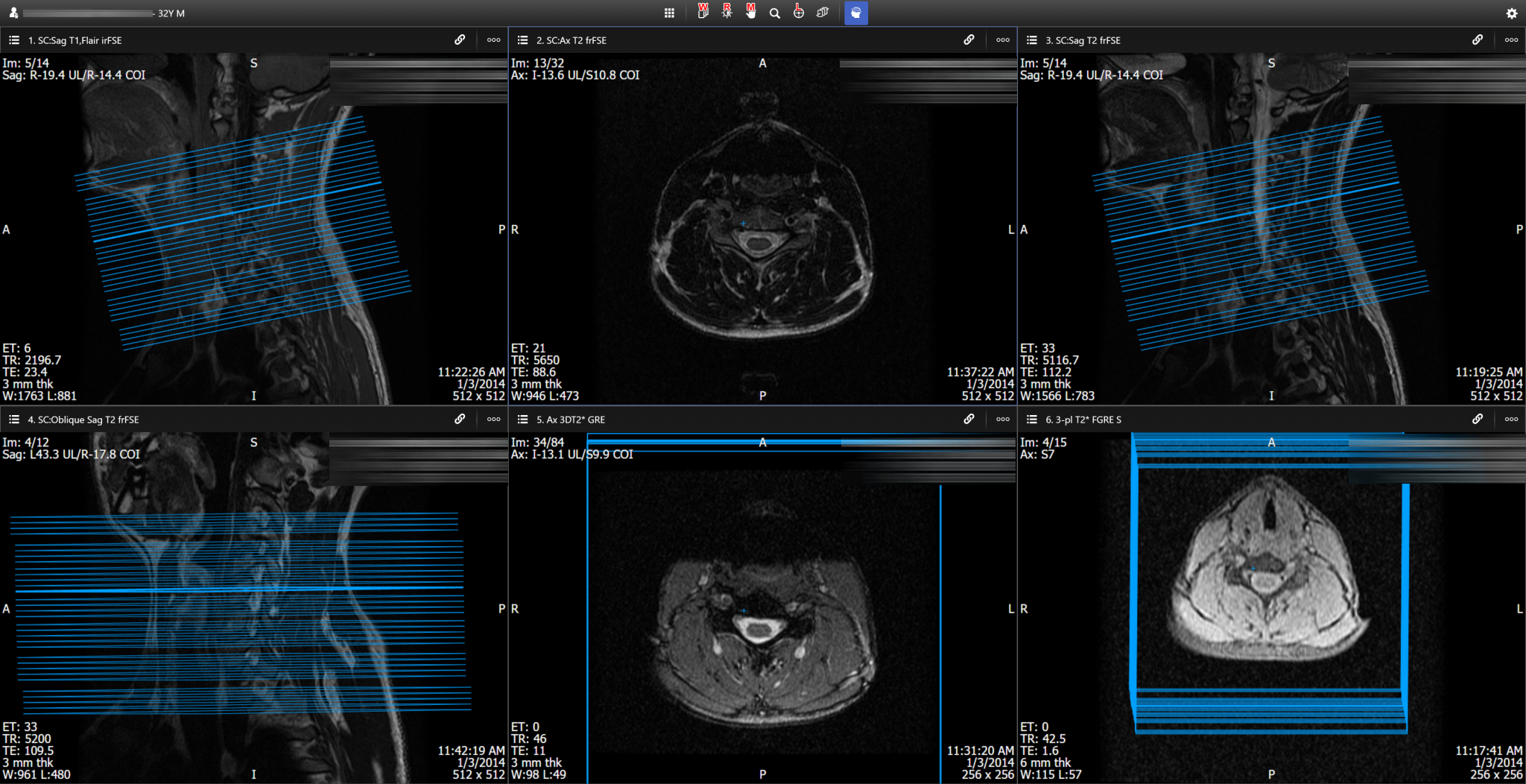 open source radiology information systems